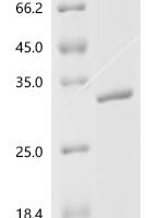 Human Stathmin-2 (STMN2) Recombinant Protein - BioCrest Sci