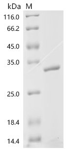 Human Stathmin-2 (STMN2) Recombinant Protein, Homo sapiens (Human), E.coli, C-terminal 6xHis-tagged, 27.7 kDa, purity >≥ 95% as determined by SDS-PAGE.