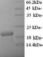 Human B-lymphocyte antigen CD20 (MS4A1), partial Recombinant Protein, N-His - BioCrest Sci
