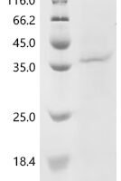 Human Protein Wnt-5a (WNT5A) Recombinant Protein, N-10His - BioCrest Sci