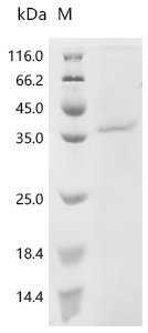 Human Protein Wnt-5a (WNT5A) Recombinant Protein, N-10His, Homo sapiens (Human), Baculovirus, N-terminal 10xHis-tagged, 37.6 kDa, purity >≥ 90% as determined by SDS-PAGE.