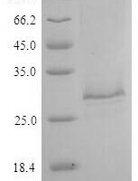 Toxocara canis 26 kDa secreted antigen (TES-26) Recombinant Protein, C-9xHis - BioCrest Sci