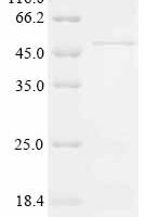 Human Dual specificity mitogen-activated protein kinase kinase 3 (MAP2K3) Recombinant Protein - BioCrest Sci