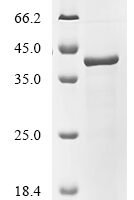 Human RNA-binding protein PNO1 (PNO1) Recombinant Protein, C-His - BioCrest Sci