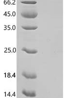Human C-X-C motif chemokine 5 (CXCL5) Recombinant Protein - BioCrest Sci