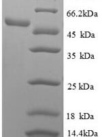 Human 60S ribosomal protein L18 (RPL18), partial Recombinant Protein - BioCrest Sci
