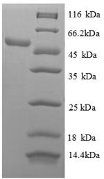 Human 60S ribosomal protein L18 (RPL18), partial Recombinant Protein, Homo sapiens (Human), E.coli, N-terminal GST-tagged, 48.4 kDa, purity >≥ 90% as determined by SDS-PAGE.