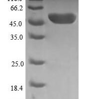 Human Thiamin pyrophosphokinase 1 (TPK1) Recombinant Protein - BioCrest Sci