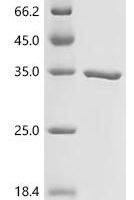 Mouse Three prime repair exonuclease 2 (Trex2) Recombinant Protein - BioCrest Sci