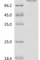 Human Neurosecretory protein VGF (VGF) Recombinant Protein, C-His - BioCrest Sci