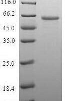 LIM and senescent cell antigen-like-containing domain protein 1 Recombinant Protein - BioCrest Sci