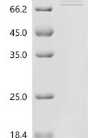 Human Butyrophilin-like protein 2 (BTNL2), partial Recombinant Protein, C-hFc1, aa 24–457 - BioCrest Sci
