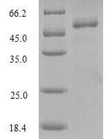 Human Adenylate kinase 2, mitochondrial (AK2) Recombinant Protein - BioCrest Sci