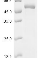 Chicken Albumin (ALB), partial Recombinant Protein - BioCrest Sci