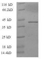 Mouse Thrombospondin-3 (Thbs3), partial Recombinant Protein, N-GST, Mus musculus (Mouse), E.coli, N-terminal GST-tagged, 62.7 kDa, purity >≥ 90% as determined by SDS-PAGE.