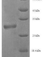 Horse Myelin P2 protein (PMP2) Recombinant Protein, N-His-SUMO - BioCrest Sci