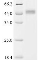 Human Ubiquitin-like modifier-activating enzyme 6 (UBA6), partial Recombinant Protein - BioCrest Sci
