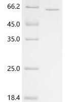Human L-amino-acid oxidase (IL4I1), partial Recombinant Protein, C-His - BioCrest Sci