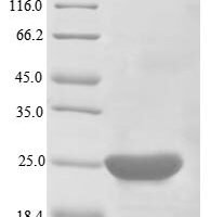 Human Apoptosis regulator Bcl-2 (BCL2), partial Recombinant Protein - BioCrest Sci
