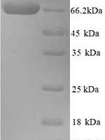 Human Cholinesterase (BCHE) Recombinant Protein - BioCrest Sci