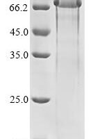 Human Polycystin-1 (PKD1), partial Recombinant Protein - BioCrest Sci