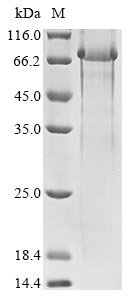 Human Polycystin-1 (PKD1), partial Recombinant Protein, Homo sapiens (Human), E.coli, N-terminal 6xHis-tagged, 69.3 kDa, purity >≥ 85% as determined by SDS-PAGE.