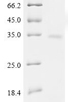 Rat Meteorin-like protein (Metrnl) Recombinant Protein, C-His - BioCrest Sci