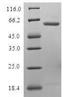 Human Ubiquitin fusion degradation protein 1 homolog (UFD1L) Recombinant Protein, N-GST - BioCrest Sci