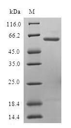 Human Ubiquitin fusion degradation protein 1 homolog (UFD1L) Recombinant Protein, N-GST, Homo sapiens (Human), E.coli, N-terminal GST-tagged, 61.5 kDa, purity >≥ 90% as determined by SDS-PAGE.