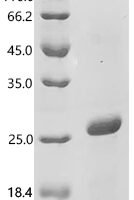 Rat Leptin (Lep) Recombinant Protein - BioCrest Sci