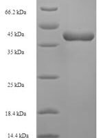 Human Tumor necrosis factor ligand superfamily member 12 (TNFSF12), partial Recombinant Protein, N-His-SUMO - BioCrest Sci