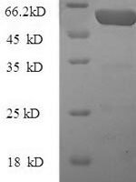 Human Pregnancy zone protein (PZP), partial Recombinant Protein - BioCrest Sci
