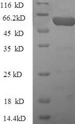 Human Pregnancy zone protein (PZP), partial Recombinant Protein, Homo sapiens (Human), Yeast, N-terminal GST-tagged, 65.3 kDa, purity >≥ 90% as determined by SDS-PAGE.