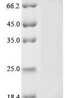 Human NACHT, LRR and PYD domains-containing protein 6 (NLRP6) Recombinant Protein - BioCrest Sci