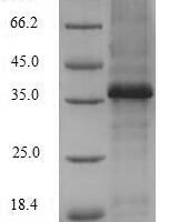 Human Versican core protein (VCAN), partial Recombinant Protein - BioCrest Sci
