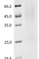 Klebsiella pneumoniae Fimbrial subunit type 3 (mrkA) Recombinant Protein, C-His - BioCrest Sci