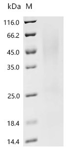Klebsiella pneumoniae Fimbrial subunit type 3 (mrkA) Recombinant Protein, C-His, Klebsiella pneumoniae, Yeast, C-terminal 6xHis-tagged, 20.0 kDa, purity >≥ 95% as determined by SDS-PAGE.