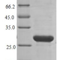 Human NADPH oxidase 4 (NOX4), partial Recombinant Protein - BioCrest Sci