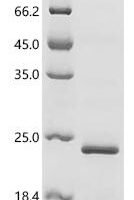 Human papillomavirus 70 Protein E7 (E7) Recombinant Protein - BioCrest Sci