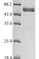 Horse Prolactin (PRL) Recombinant Protein, C-hFc1 - BioCrest Sci
