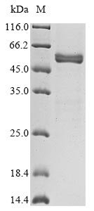 Horse Prolactin (PRL) Recombinant Protein, C-hFc1, Equus caballus (Horse), Mammalian cell, C-terminal hFc1-tagged, 51.9 kDa, purity >≥ 85% as determined by SDS-PAGE.