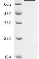 Human Deformed epidermal autoregulatory factor 1 homolog (DEAF1) Recombinant Protein, C-His - BioCrest Sci