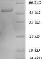 Human Rho GDP-dissociation inhibitor 1 (ARHGDIA) Recombinant Protein - BioCrest Sci