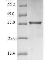 Mouse Tumor necrosis factor (Tnf), partial Recombinant Protein - BioCrest Sci