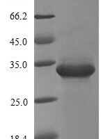Escherichia coli Transcriptional regulatory protein PhoP (phoP) Recombinant Protein - BioCrest Sci