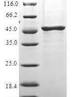 Human Interleukin-37 (IL37) Recombinant Protein - BioCrest Sci