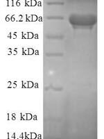 Human Eukaryotic translation initiation factor 3 subunit F (EIF3F), partial Recombinant Protein - BioCrest Sci
