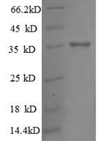 Escherichia coli 30S ribosomal protein S18 (rpsR) Recombinant Protein - BioCrest Sci