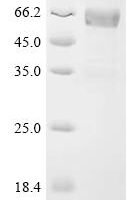 Human Sclerostin domain-containing protein 1 (SOSTDC1) Recombinant Protein, C-hFc1 - BioCrest Sci