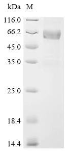 Human Sclerostin domain-containing protein 1 (SOSTDC1) Recombinant Protein, C-hFc1, Homo sapiens (Human), Mammalian cell, C-terminal hFc1-tagged, 49.7 kDa, purity >≥ 85% as determined by SDS-PAGE.